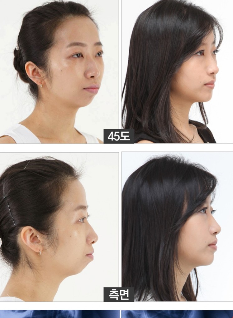cropped-blog-jade-plastic-surgery-before-and-after1.jpg