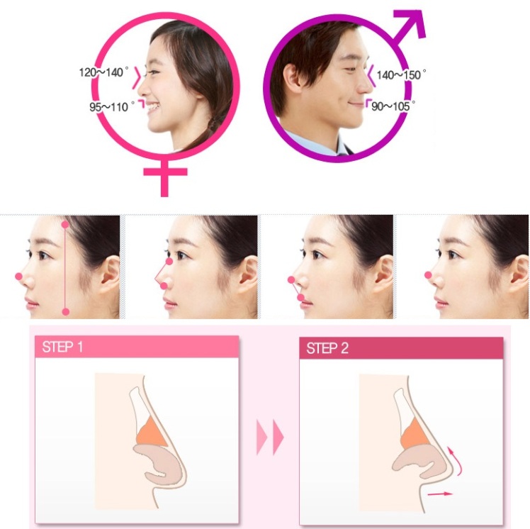 7 28 downward pointed nose jade plastic surgery seoul korea rhinoplasty